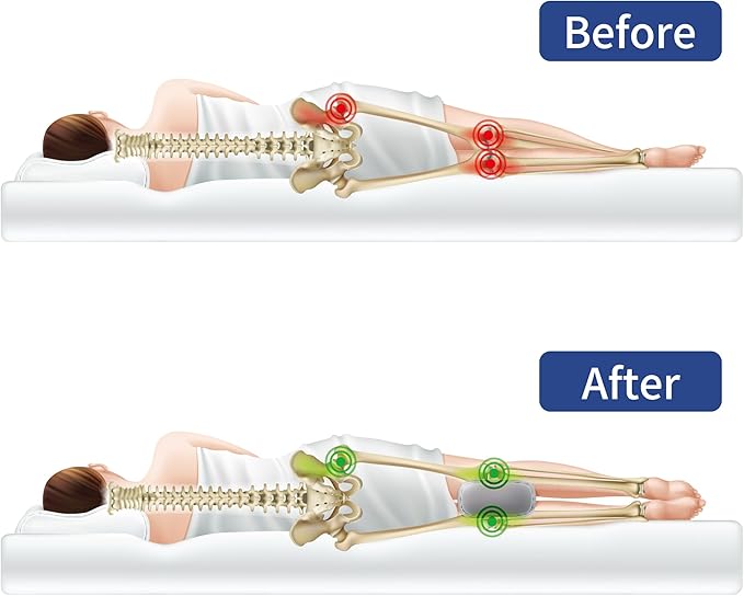 HOMBYS Knee Pillow for Side Sleepers with Groove, Down Alternative Between Leg Pillow for Sleeping,Under Knee Pillow for Sleeping on Back,Spine Alignment, Lower Back Pain Relief, Machine Washable